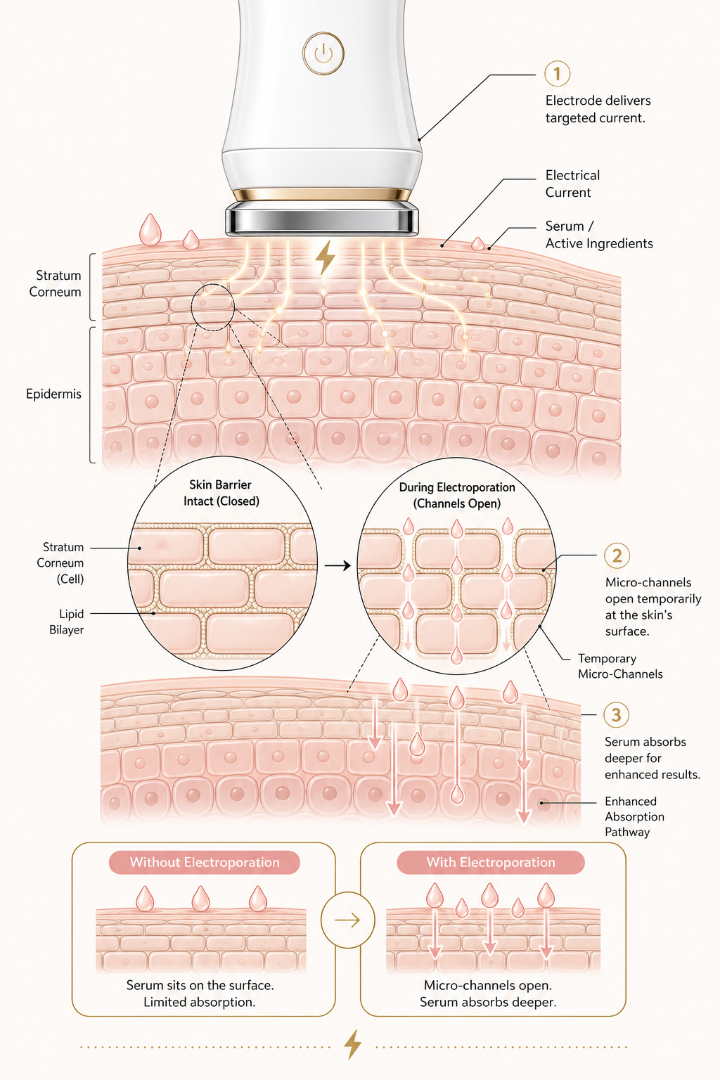 How electroporation works